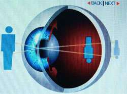 Διόρθωση παθήσεων της όρασης με Laser