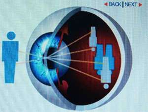 Διόρθωση παθήσεων της όρασης με Laser