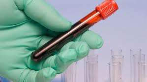Γονιδιακή θεραπεία αποδεικνύεται αποτελεσματική στην αιμορροφιλία