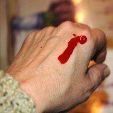 17 Απριλίου: Παγκόσμια Ημέρα Αιμορροφιλίας
