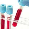 Αιμοδοσία και η στάση των εθελοντών αιμοδοτών