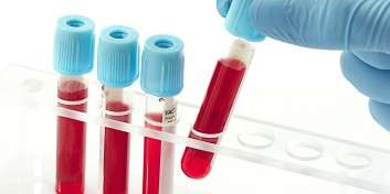 Αιμοδοσία και η στάση των εθελοντών αιμοδοτών