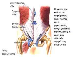 Tο σύνδρομο κοιλιακών προσαγωγών ή αλλιώς κήλη των αθλητών (sportsman's hernia)