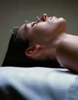 Acupuncture for smoking cessation & Detox