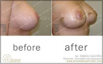 before-after03b