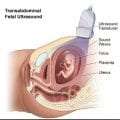 Πώς και πότε γίνεται το εμβρυϊκό υπερηχογράφημα