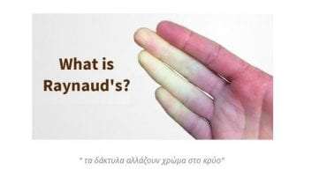 Τι είναι το "Raynaud