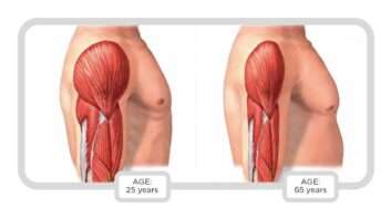 ΣΑΡΚΟΠΕΝΙΑ (SARCOPENIA)