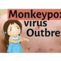 Ευλογιά του ανθρώπου (smallpox),ευλογιά των αγελάδων (cowpox-δαμαλίτιδα) και ευλογιά των πιθήκων (monkeypox),